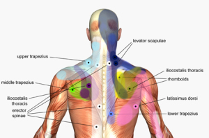 trigger point therapy calgary